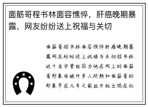 面筋哥程书林面容憔悴，肝癌晚期暴露，网友纷纷送上祝福与关切